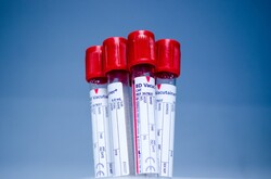 Tube for testing in laboratory