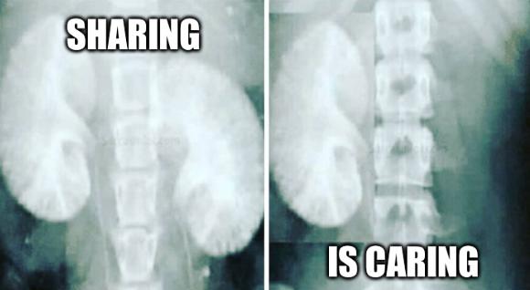 Kidney X-ray: Sharing is caring