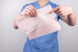 Doctor with Cardiogram pulse trace