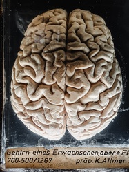 Human brain in a jar